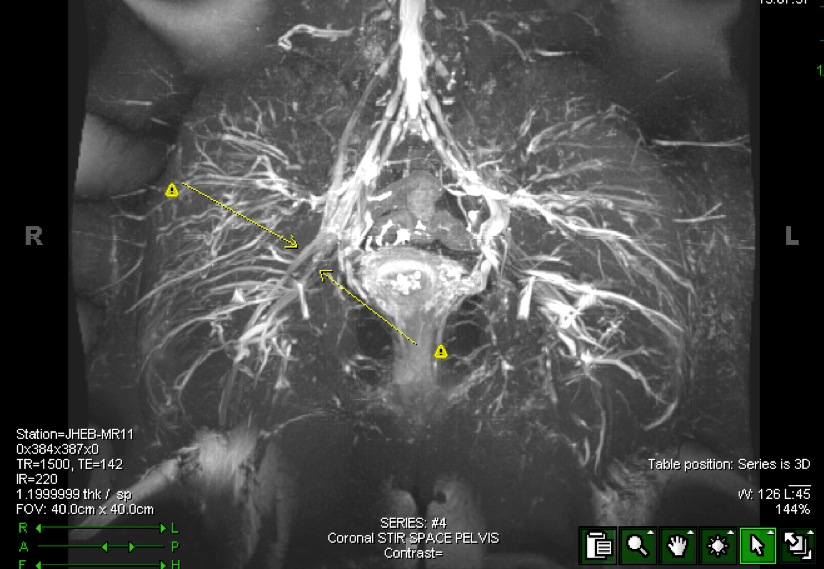 Figure 7 for case split right sciatic